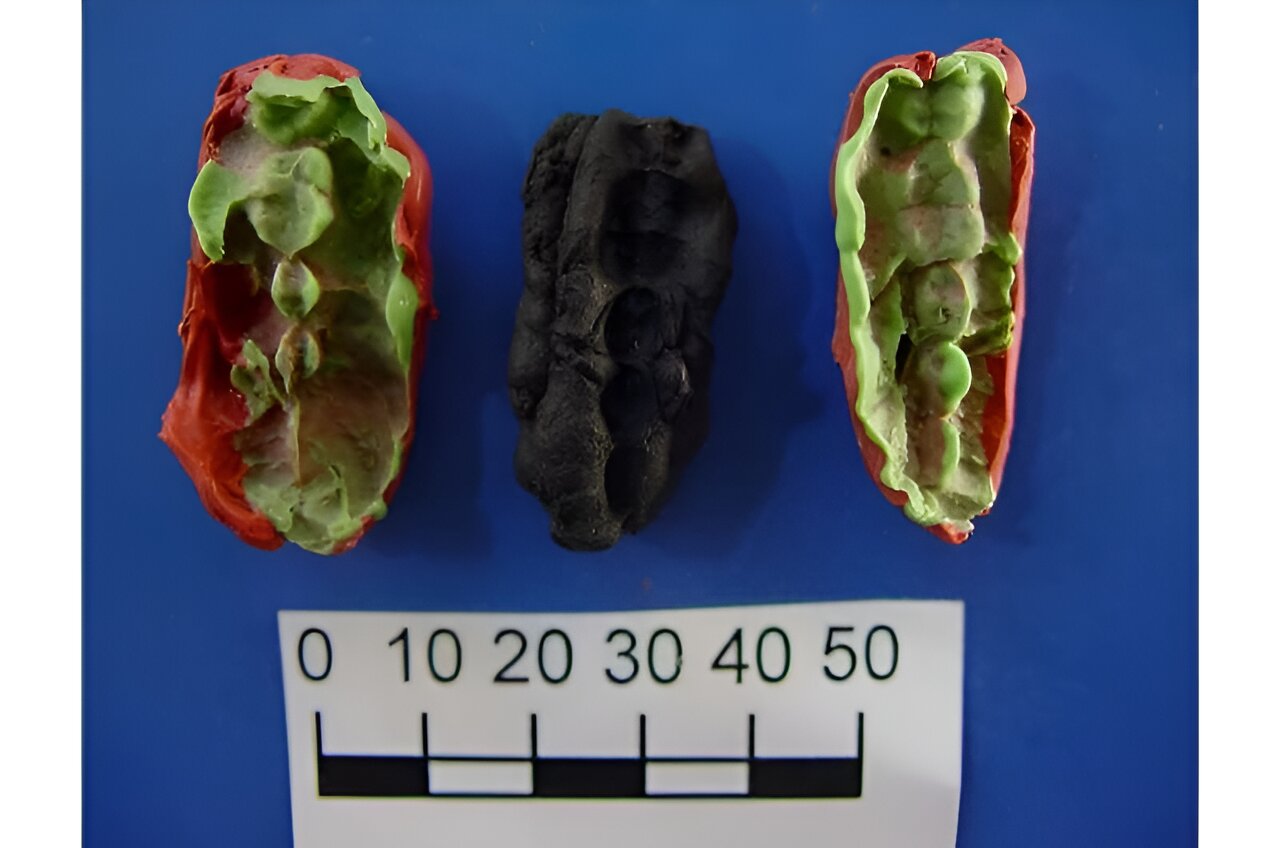 Zahnstein, Parodontose und die letzte Mahlzeit: Kaugummi mit steinzeitlichen Zahnabdrücken als konservierte DNA